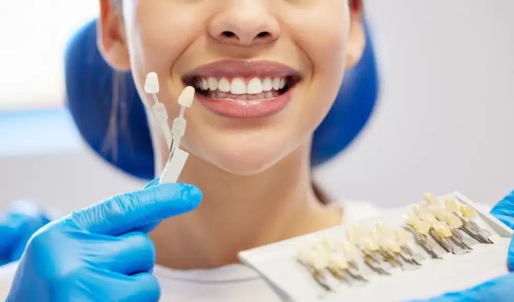 Top Reasons to Get Teeth Whitening Treatment in Jammu