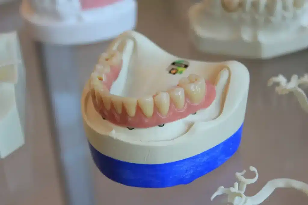 A dummy mouth model showing teeth structure used for mouth rehabilitation procedures