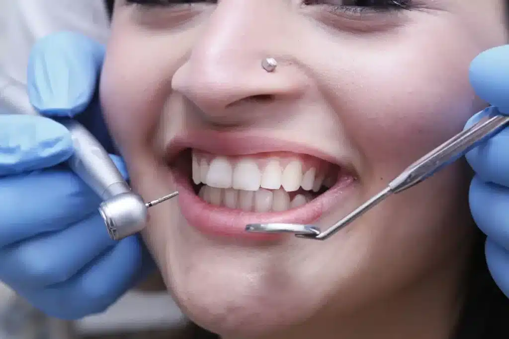 Dentist performing smile designing procedure using dental instruments on a patient
