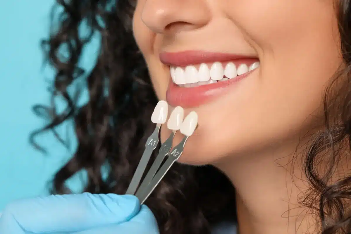 A happy woman smiling outdoors holding dental veneers in her hand